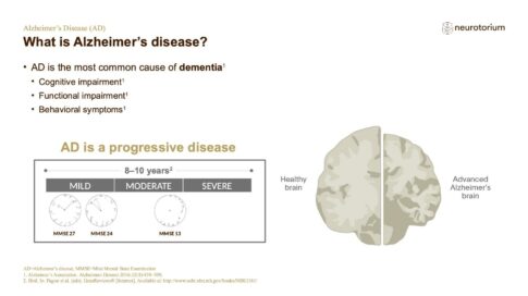 Alzheimers Disease – Diagnosis and Definitions – slide 6